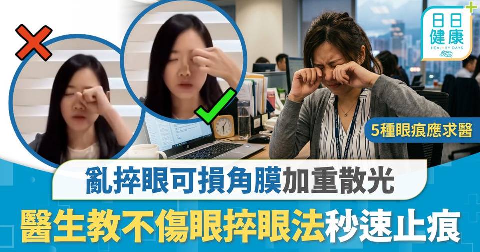 眼部健康|亂捽眼可損角膜加重散光 醫生教不傷眼捽眼法 有效止痕同時紓緩疲勞 | 眼科 | 東方新地