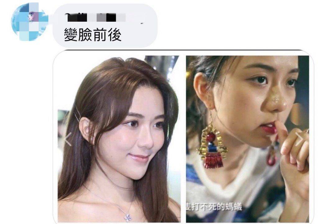 又有網民貼出陳聖瑜新舊照側面對比，指她變臉前後。