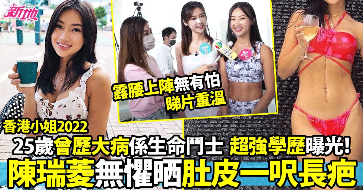 陳瑞菱大熱落選香港小姐2022︱25歲碩士畢業、肚皮留疤一呎長曾有慘痛經歷