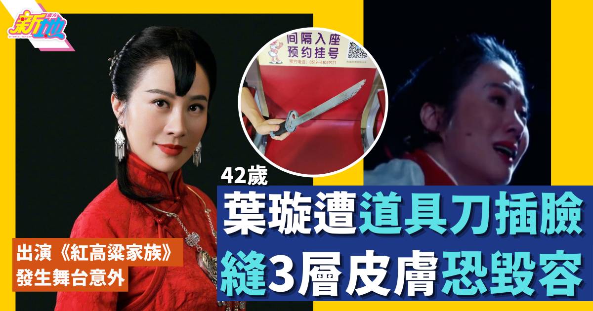 42歲葉璇演舞台劇被道具刀穿臉恐毀容 血流不止往急症室縫3層皮膚