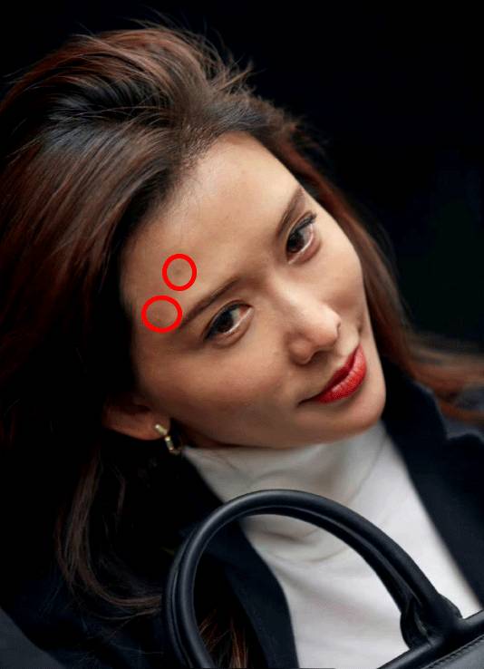 林志玲 近日有內地網民流出林志玲的零修圖廣告原圖，歲月不留人，額頭上的石頭瘡原形畢露。