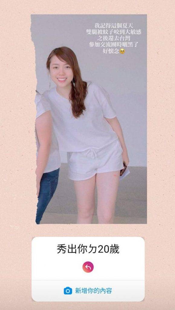 梁凱寧 20歲的唐海汶穿著一身白T恤加白色熱褲，被網民取笑她選擇貼出這張相，並非是想曬被蚊咬的痕跡，而是想曬出自己一對白到反光的長腿。