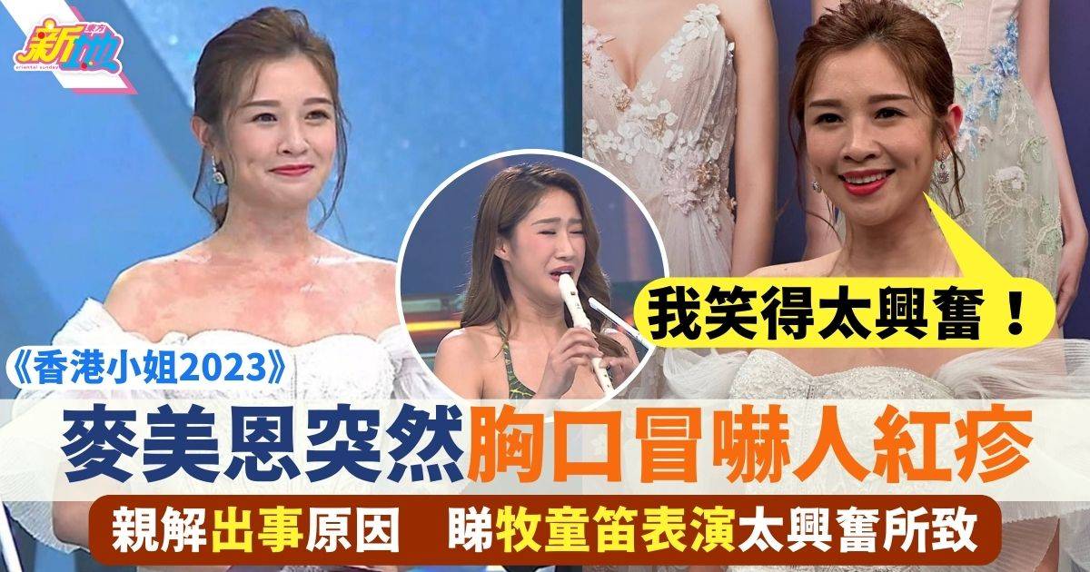 香港小姐2023︱麥美恩胸口冒紅疹超嚇人 事後親自解畫多謝網民關心