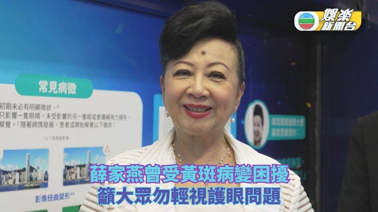 薛家燕曾受黃斑病變困擾 籲大眾勿輕視護眼問題
