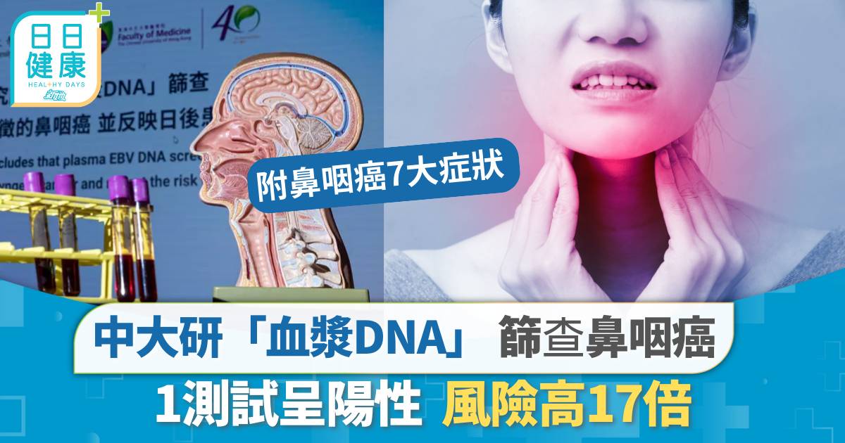 鼻咽癌篩查｜中大研「血漿DNA」篩查 偵測早期無病徵鼻咽癌