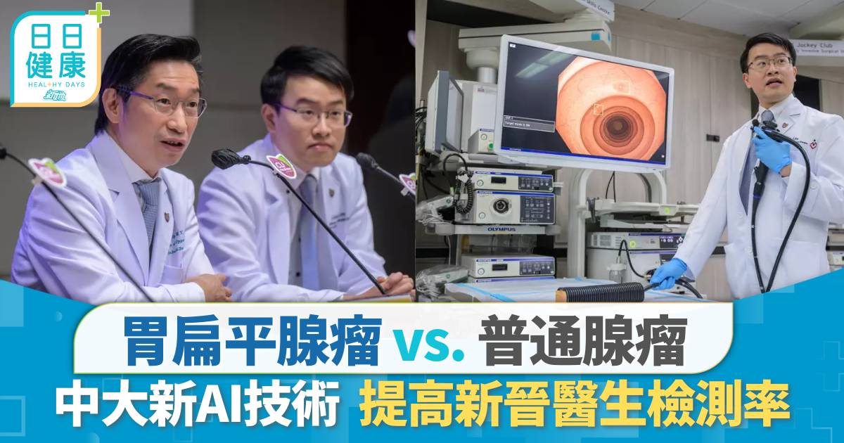 大腸癌檢測｜AI送醫生30年經驗值？ 中大：輔助醫生進行內窺鏡+手術