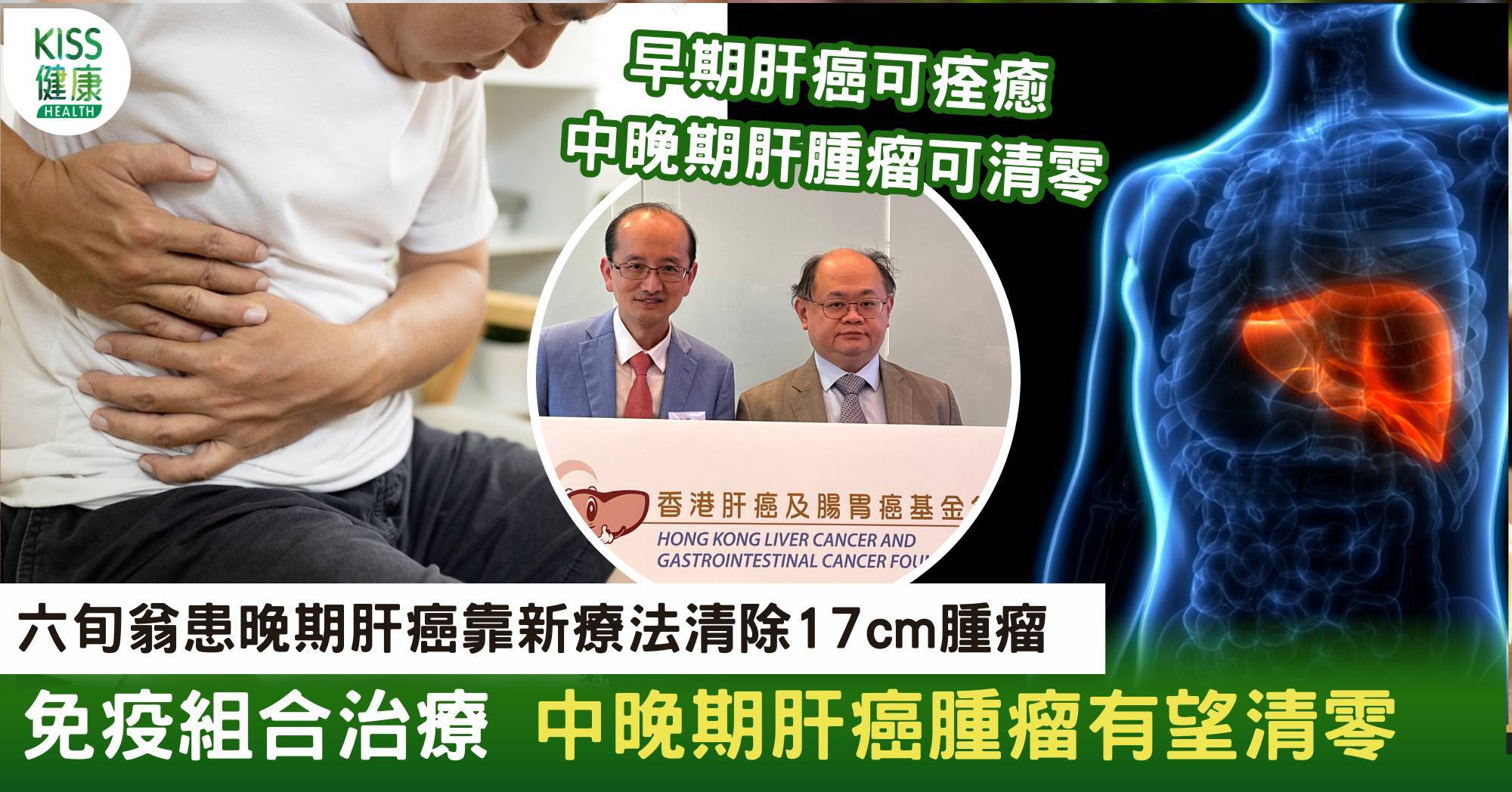 六旬翁患晚期肝癌被指剩半年命 免疫組合治療成功清除17cm腫瘤