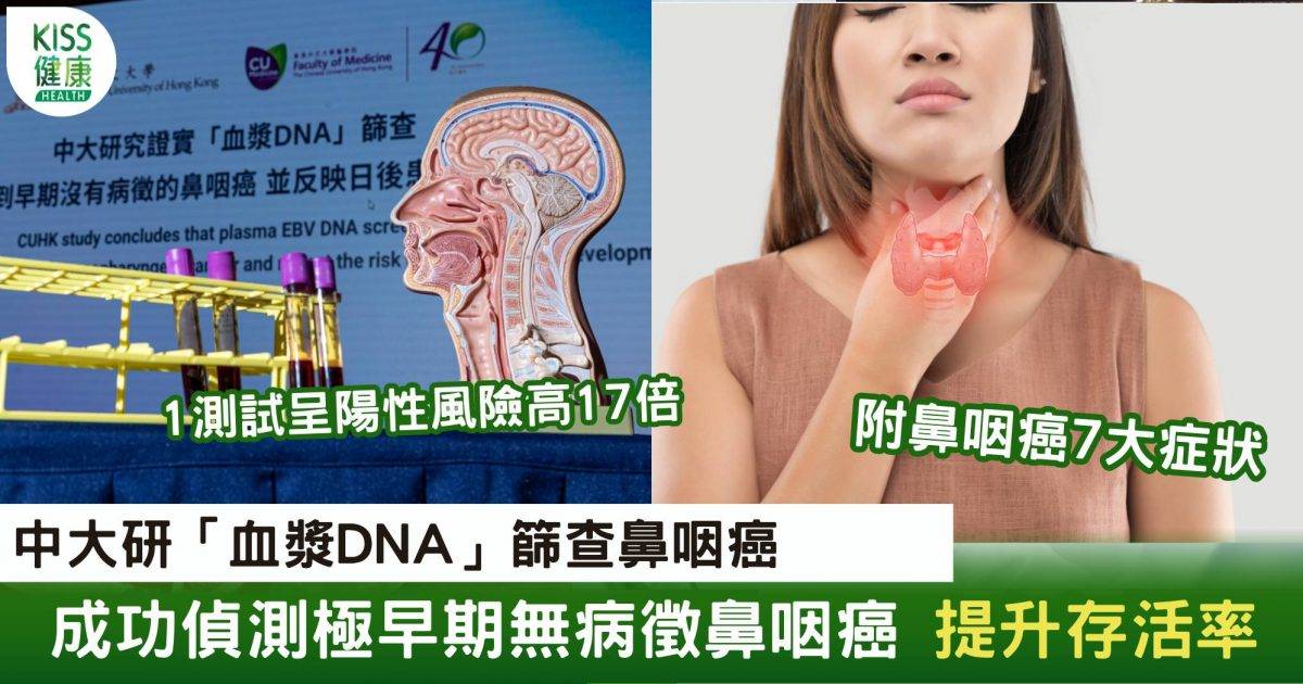 鼻咽癌篩查｜中大研「血漿DNA」篩查 偵測早期無病徵鼻咽癌