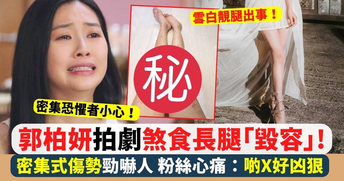 27歲郭柏妍拍劇煞食長腿爭啲「毀容」 密集式傷勢嚇親粉絲：好凶狠！