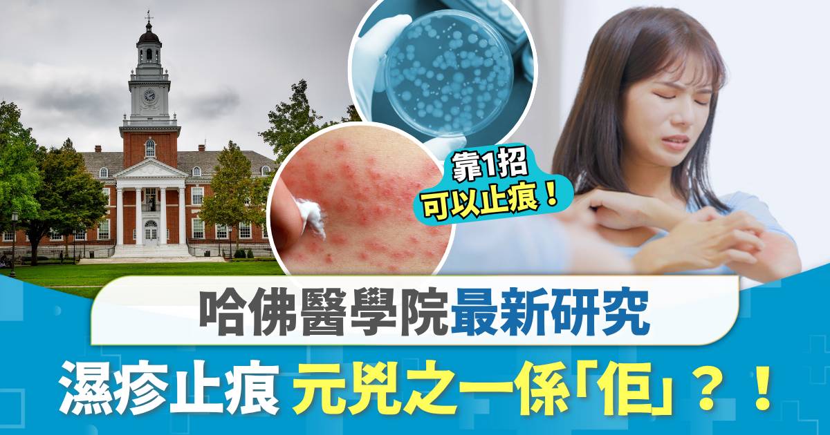 哈佛醫學院發現濕疹致痕元兇之一原來是「它」？內附1招從根源紓緩濕疹痕癢