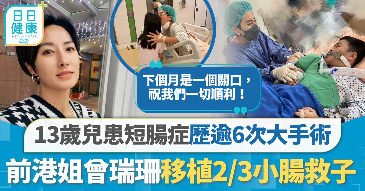 短腸症｜13歲兒患短腸從未用口進食 前港姐曾瑞珊移植2/3小腸救子