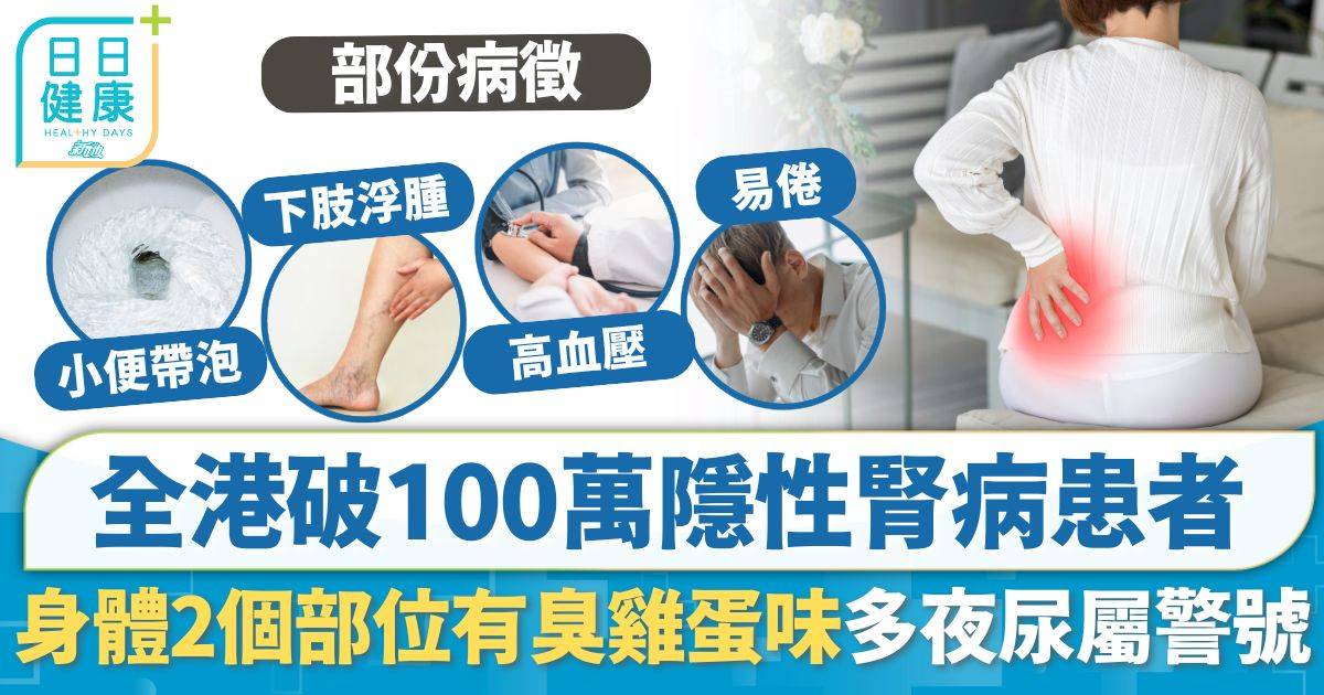 腎病｜全港破100萬隱性腎病患者 身體2個部位有臭雞蛋味屬病徵