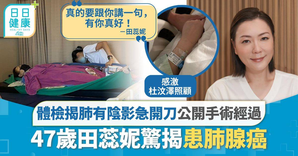 田蕊妮患肺腺癌｜體檢揭肺有陰影急開刀 公開手術經過 感激杜汶澤照顧