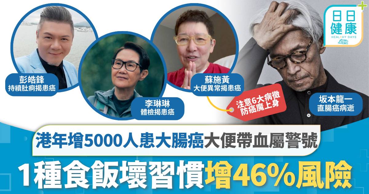 大腸癌｜港年增5000患者 多名藝人大便帶血揭罹癌 1種食飯習慣增46％風險