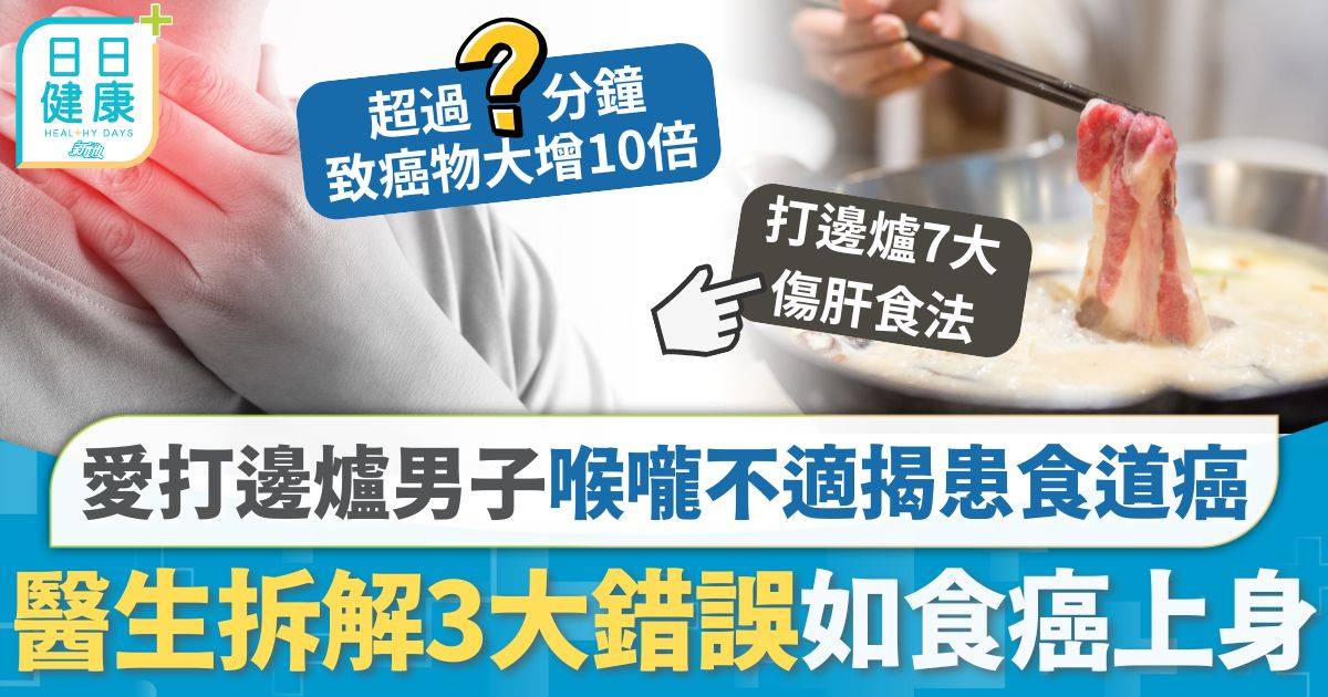 男子愛好打邊爐 致喉嚨不適揭患食道癌 醫生提3種錯誤行為如食癌上身