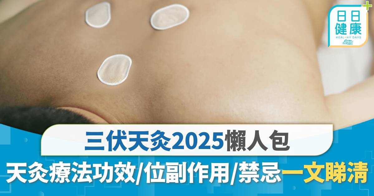 三伏天灸2025｜天灸療法紓緩哮喘 功效/副作用/禁忌一文睇清