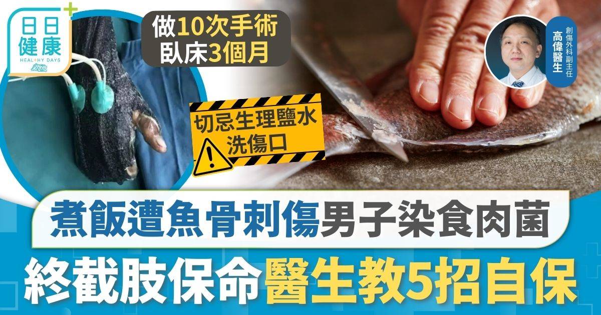 食肉菌 壞死性筋膜炎