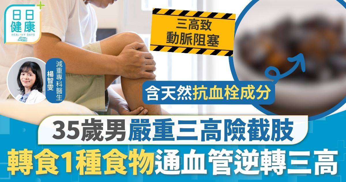 35歲男嚴重三高險截肢 醫生建議食1種通血管食物 3個月逆轉三高激減22磅