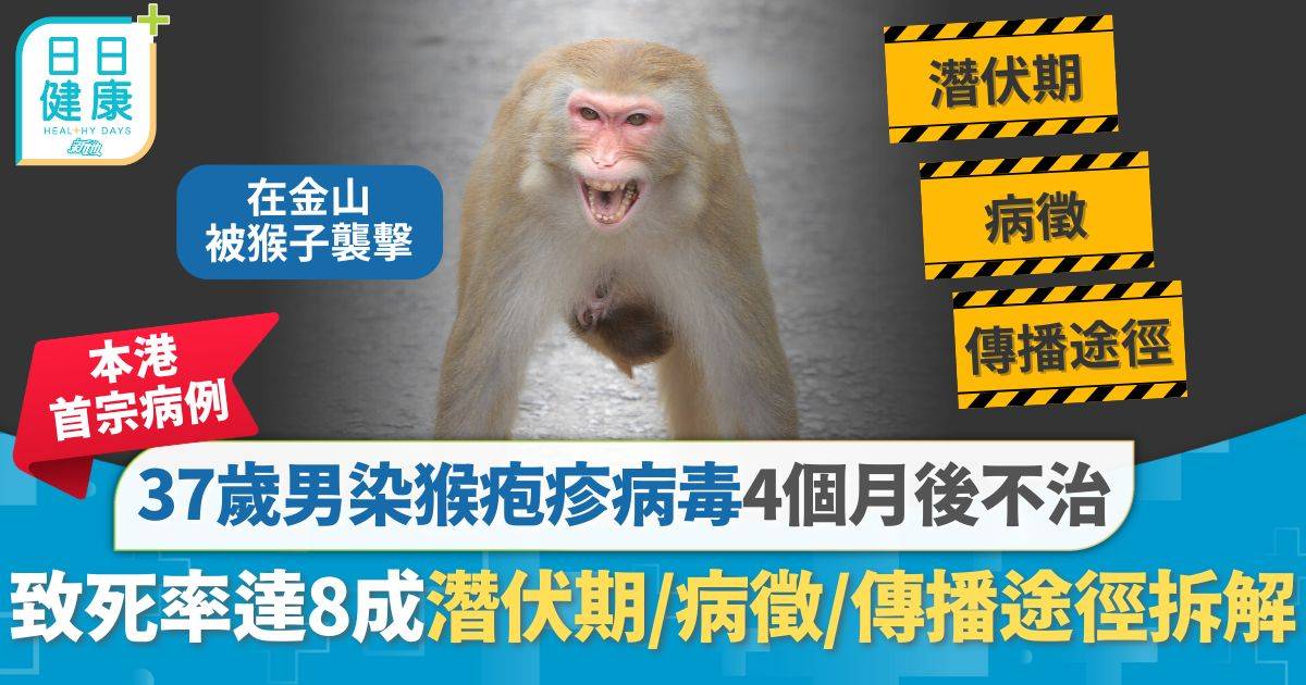 猴疱疹病毒｜港男被金山猴子襲擊感染4個月後不治 致死率高達8成  潛伏期/病徵/傳播途徑拆解