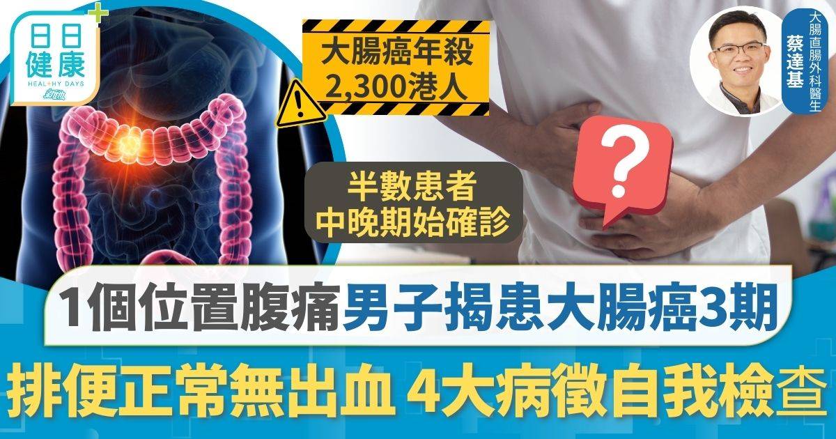 1個位置腹痛揭患大腸癌3期 男子排便正常無出血 4大高危病徵自我檢查