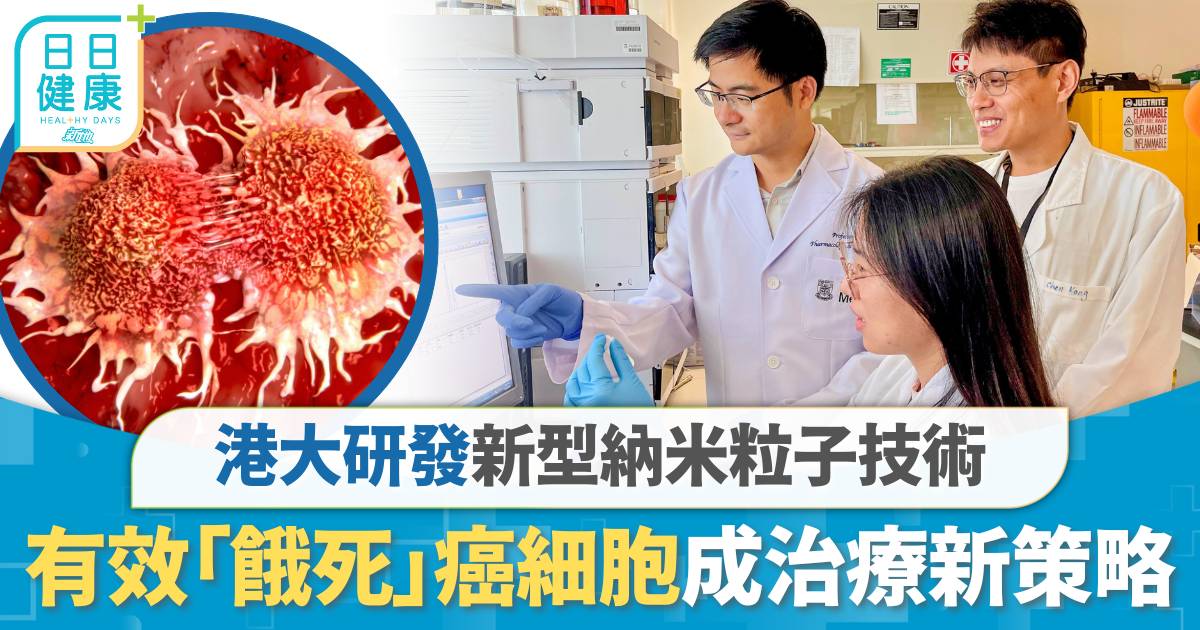癌症治療｜港大研發新型納米粒子技術 成功「餓死」癌細胞成治療新策略