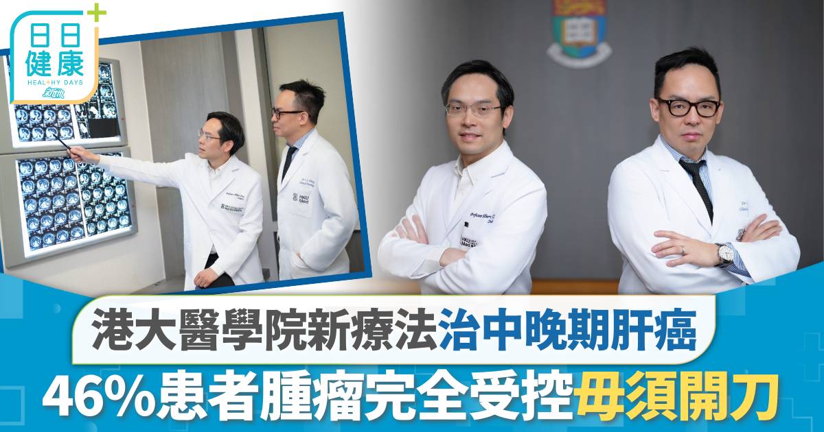 港大醫學院新療法治中晚期肝癌 46%患者腫瘤完全受控毋須開刀