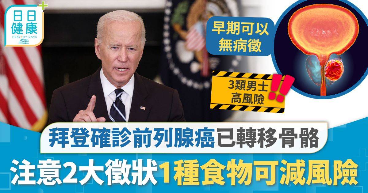 前列腺癌｜美國前總統拜登確診前列腺癌已轉移骨骼 專家拆解存活時期 注意2大徵狀1種食物可減風險