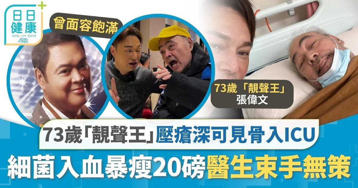 73歲「靚聲王」壓瘡深可見骨入icu 細菌入血暴瘦20磅醫