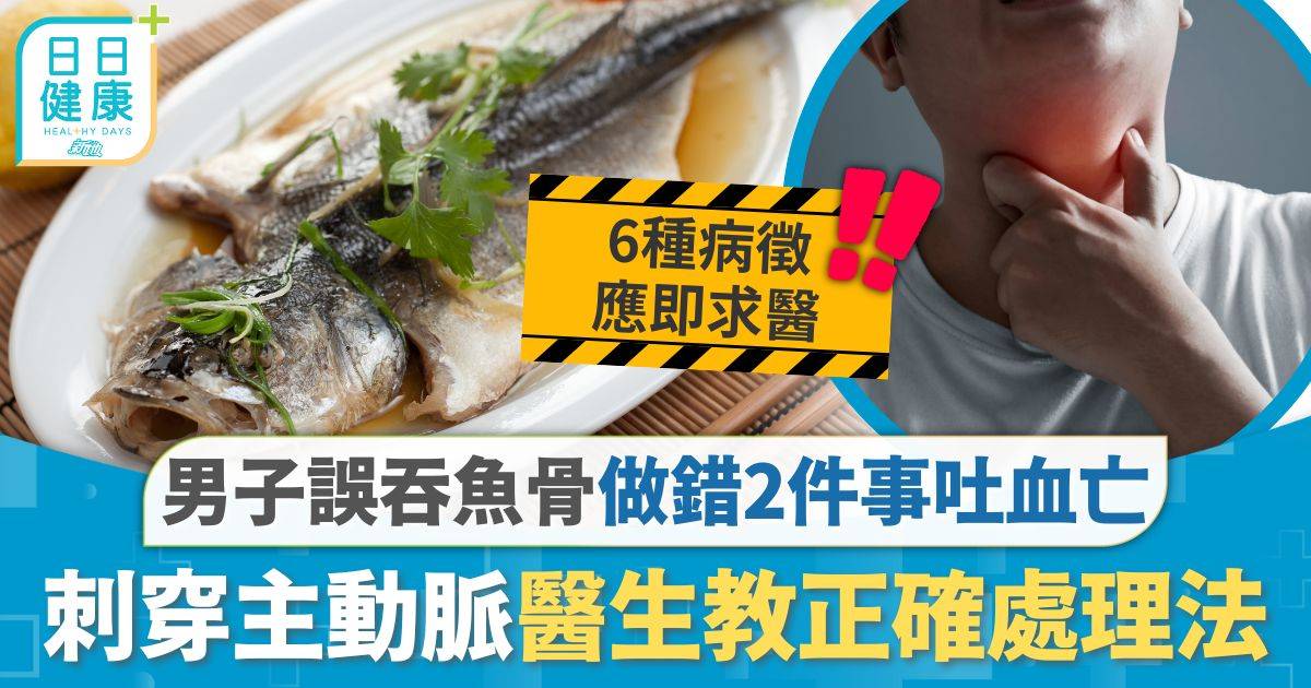 鯁喉處理｜誤吞魚骨後做錯2件事 29歲男2日後吐血身亡 魚骨刺穿主動脈醫生教正確處理法