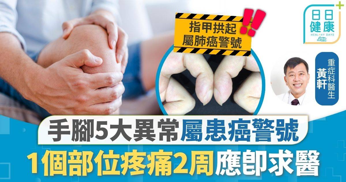 癌症 病徵 癌症先兆｜手腳5大異常屬患癌警號 1個部位疼痛2周應即求醫 指甲根部拱起恐患肺癌