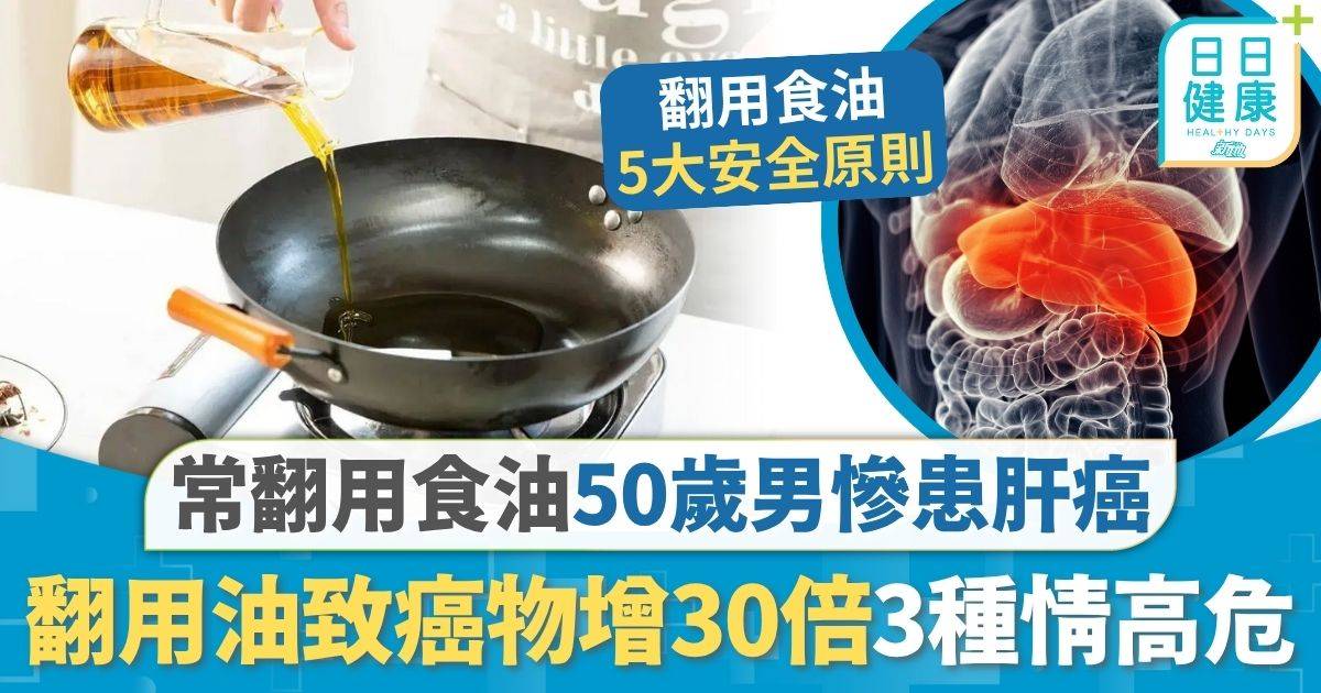 煮食安全｜常翻用食油50歲男慘患肝癌 翻用食油致癌物暴增30倍 拆解3種情況應即丟棄