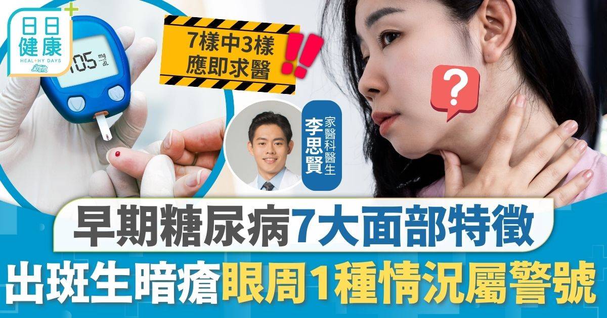 糖尿病｜全港70萬人患糖尿 拆解早期糖尿病7大面部特徵 有斑點眼袋屬警告中3樣應即求醫