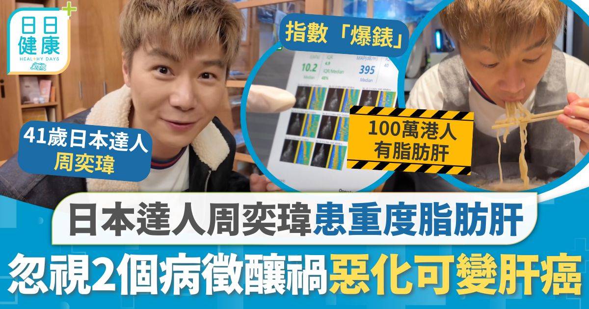 飲食健康｜日本達人周奕瑋患重度脂肪肝 後悔忽視2個病徵釀禍 注意5大病徵惡化可變肝癌
