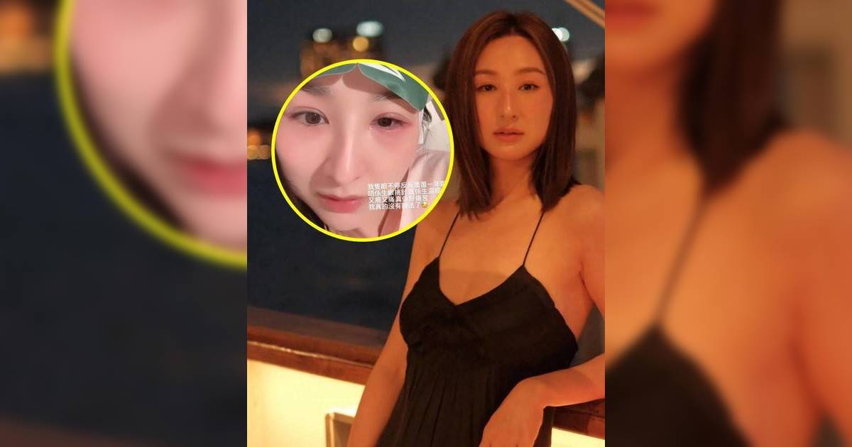 高海寧左眼紅腫一年未癒 健康再亮紅燈粉絲喊心痛 揭劇組經歷最離譜事件