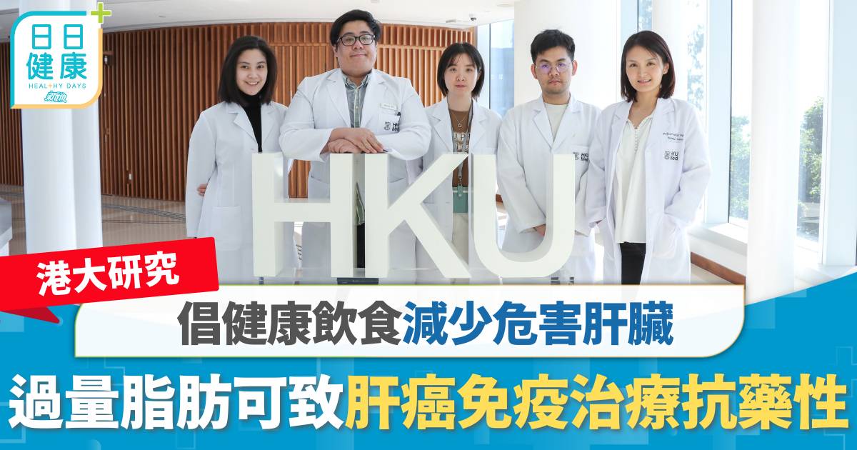 港大研究｜過量脂肪可致肝癌免疫治療抗藥性 倡健康飲食減少危害肝臟