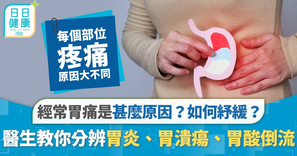 經常胃痛是甚麼原因？ 醫生教你簡單分辨胃炎、胃潰瘍、胃酸倒流