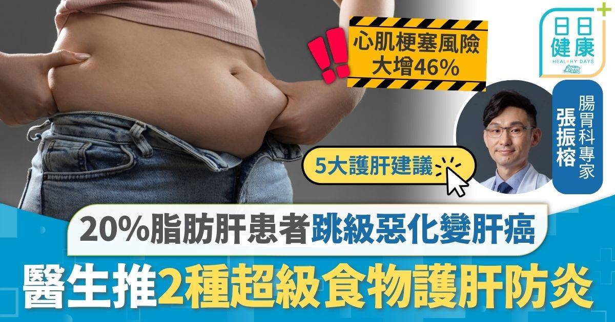 脂肪肝｜忽視脂肪肝可致慢性發炎 20％患者跳級惡化變肝癌 醫生推2種超級食物護肝防炎