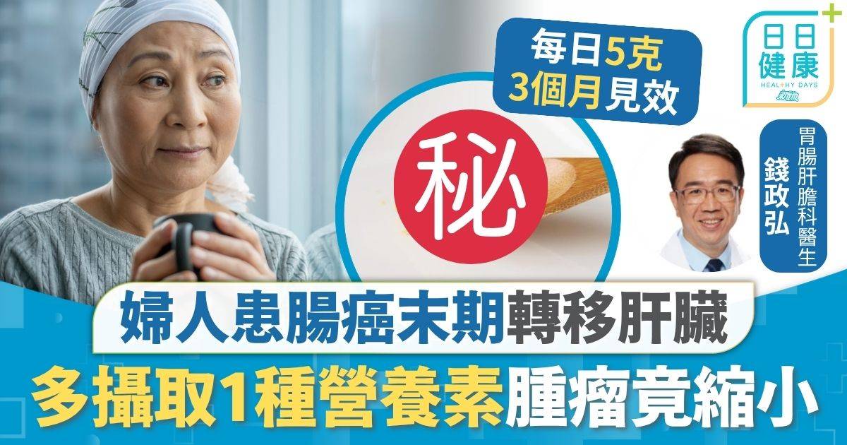大腸癌 營養素 大腸癌｜婦人患腸癌末期轉移肝臟 攝取1種營養素腫瘤竟縮小 醫生拆解關鍵食過量恐傷肝