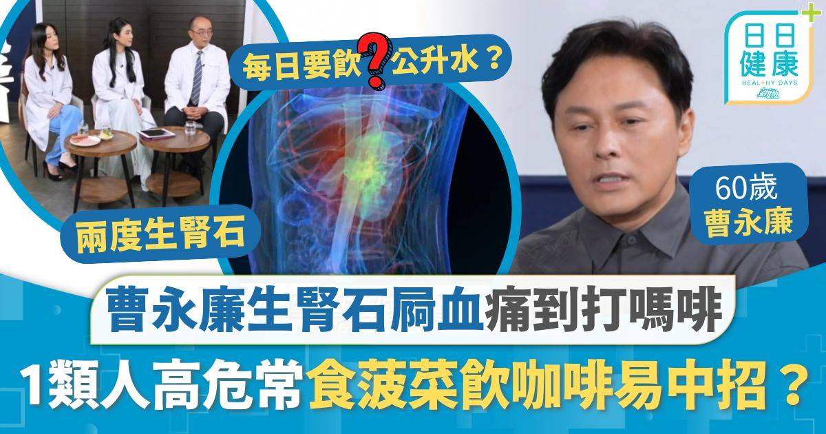 腎石 曹永廉 腎結石｜曹永廉生腎石屙血痛到打嗎啡 醫生拆解1類人腎石高危 常食菠菜／多飲咖啡易中招？