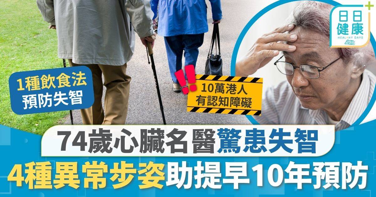失智症｜74歲心臟名醫驚患失智 4種異常步姿屬患病先兆 提早10年發現認知障礙