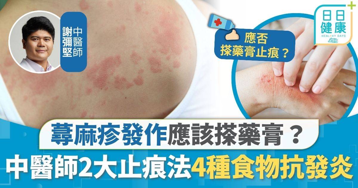 風赧 蕁麻疹 風赧/蕁麻疹｜蕁麻疹發作痕癢難當 中醫師教2大快速止痕法 4種天然食物對抗發炎