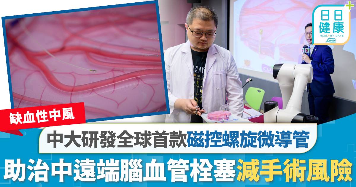 缺血性中風｜中大研發全球首款磁控螺旋微導管　助治中遠端腦血管栓塞減手術風險