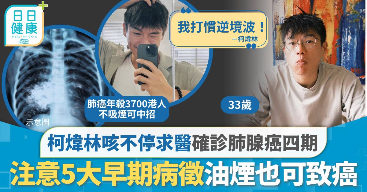 肺腺癌｜33歲柯煒林咳不停求醫確診肺腺癌四期 注意5大早期病徵 油煙也可致癌