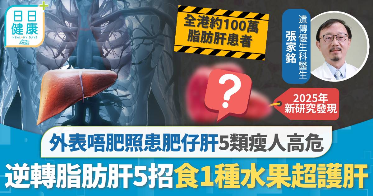 脂肪肝｜身形瘦削照患脂肪肝 醫生揭5類瘦人高危 5招逆轉多食1種水果超護肝