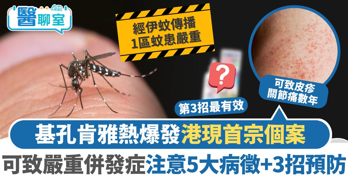 基孔肯雅熱爆發港現首宗個案 港人無抗體可致嚴重併發症 注意5大病徵+3招預防