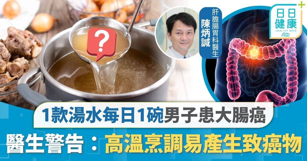 大腸癌｜1款湯水每日1碗 男子生瘜肉揭患大腸癌 醫生警告：高溫烹調易產生致癌物