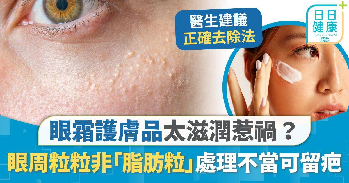 皮膚 眼霜 皮膚護理｜眼霜護膚品太滋潤惹禍？ 眼周粒粒實非「脂肪粒」 醫生拆解成因處理不當可留疤
