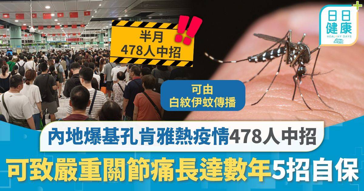 北上注意｜內地爆基孔肯雅熱疫情478人中招 感染可致嚴重關節痛長達數年 無疫苗特效藥5招自保