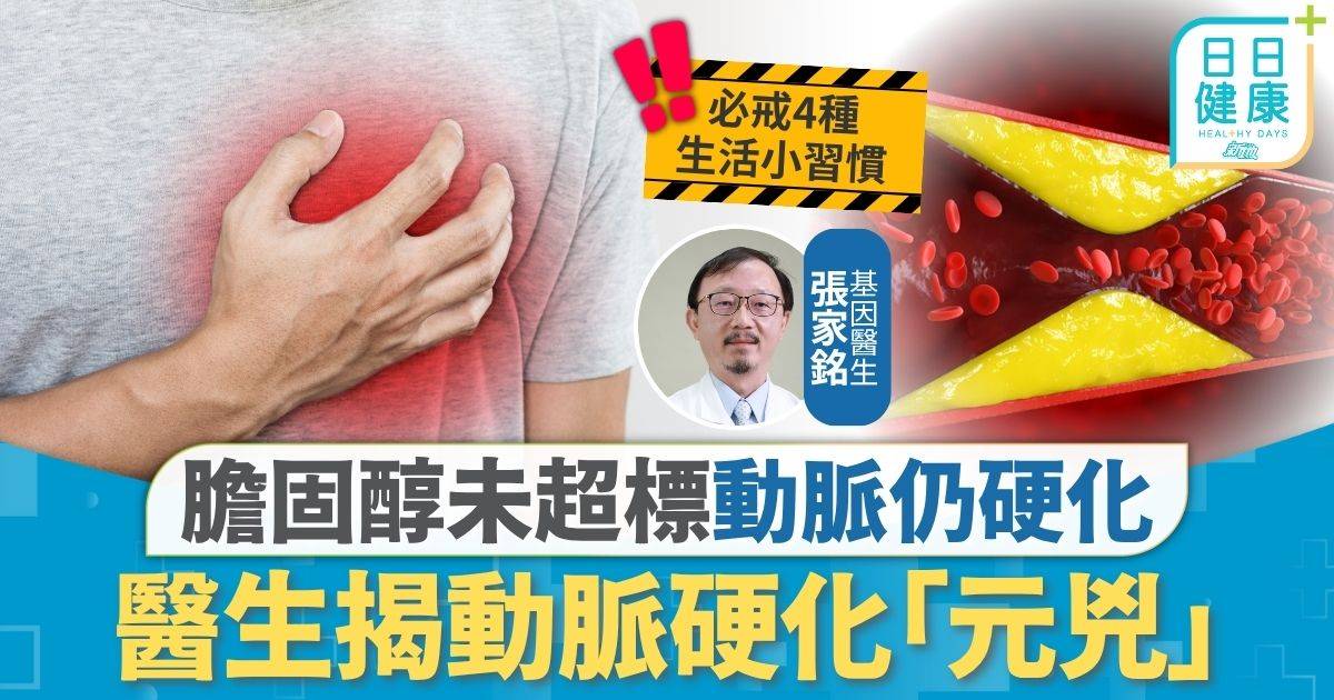 膽固醇｜膽固醇未超標動脈仍硬化 醫生揭動脈硬化「元兇」 多食2種食物防免疫過度