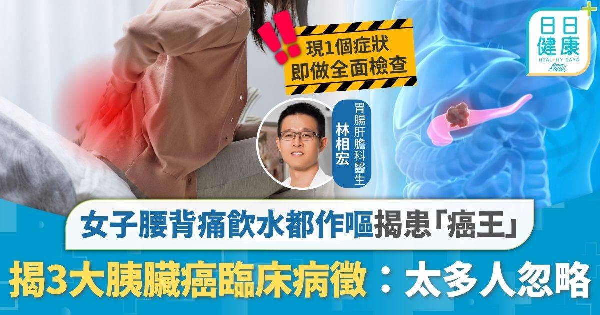 胰臟癌｜女子腰背痛飲水都作嘔 揭患「癌王」腫瘤已有3cm 3大胰臟癌臨床病徵：太多人忽略